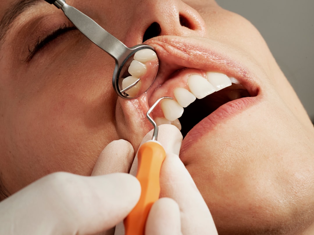 Close-up dental exam using a mirror and hand tool to check for cavities