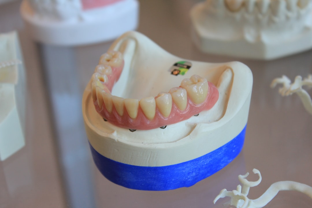 Getting a Crown: What I Wish I’d Asked the First Time