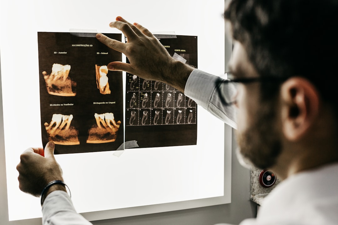 What Getting a Dental Implant Is Really Like, Start to Finish