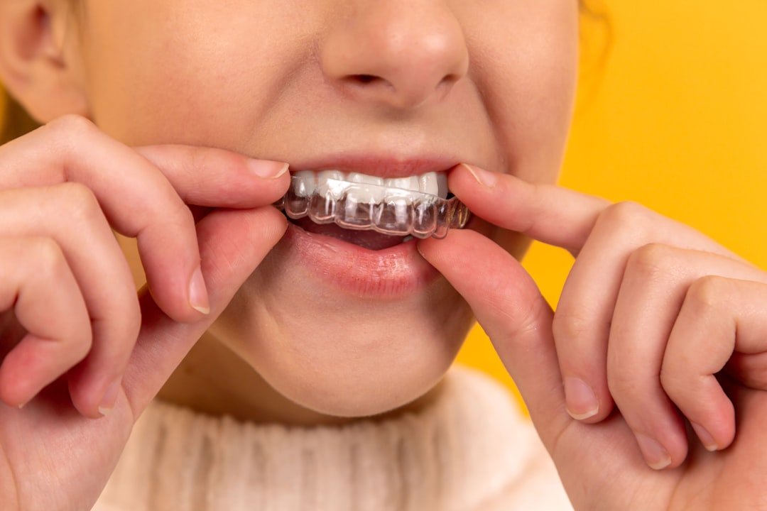 Teeth Grinding (Bruxism): Causes, Signs, and What Actually Helps
